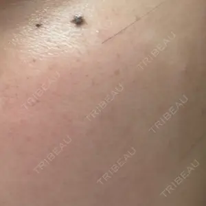 ハナビューティークリニック口コミ