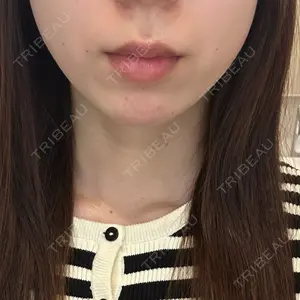口コミ