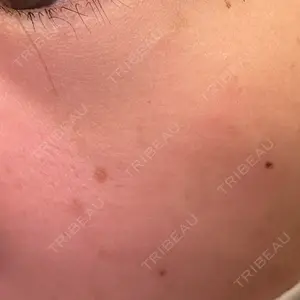 NARU Beauty Clinic NARU Beauty Clinic 【ナルクリ】 水戸院口コミ