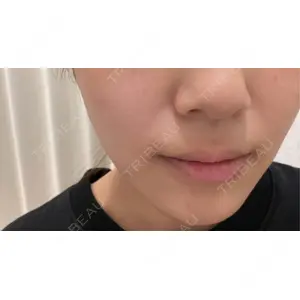 口コミ