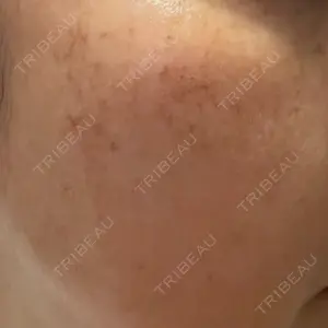 ルラ美容クリニック ルラ美容クリニック 広島院口コミ