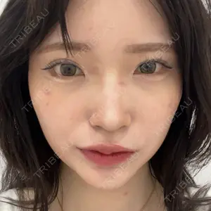 東京シンデレラ美容外科 東京シンデレラ美容外科 池袋院口コミ