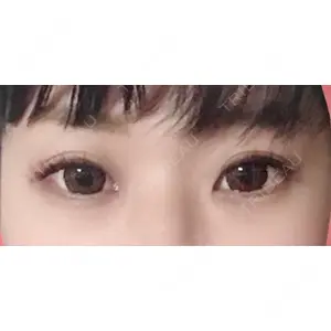 さっぽろ美容クリニック口コミ