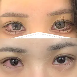 BIANCA CLINIC BIANCA銀座口コミ