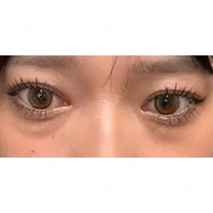 藤・ナチュレ美容クリニック 藤・ナチュレ美容クリニック 銀座院口コミ