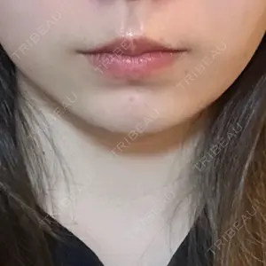 口コミ