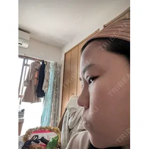 TCB東京中央美容外科 TCB東京中央美容外科 松山院口コミ