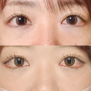 Tokyo Tensei Clinic 銀座院口コミ