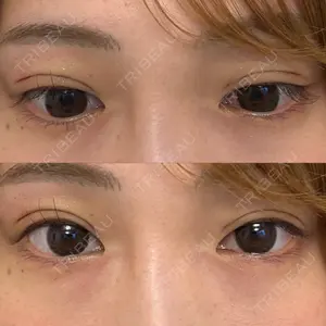 口コミ