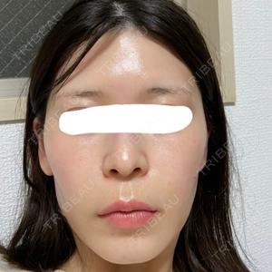 医療法人社団 東輝会 Wi Clinic （ウィ クリニック）心斎橋院口コミ
