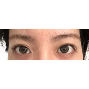 HAAB×DREAM BEAUTY CLINIC HAAB×DREAM BEAUTY CLINIC 東京本院口コミ