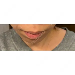 口コミ