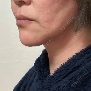 EMMO FACE CLINIC EMMO FACE CLINIC 東京三田院口コミ