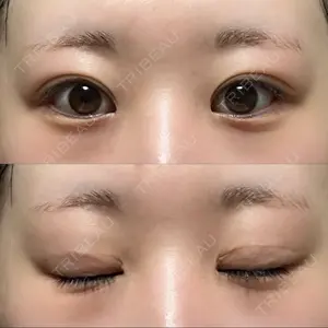 プロミス整形外科口コミ