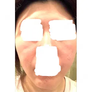 ミニマムスキンクリニック ミニマムスキンクリニック池袋口コミ