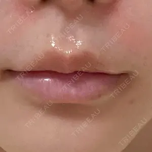 口コミ