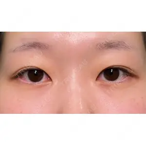 HAAB×DREAM BEAUTY CLINIC HAAB×DREAM BEAUTY CLINIC 大阪梅田院口コミ