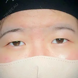 アリエル美容クリニック アリエル美容クリニック 大宮院口コミ