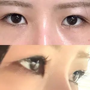 LUHO（ルホ）美容外科口コミ