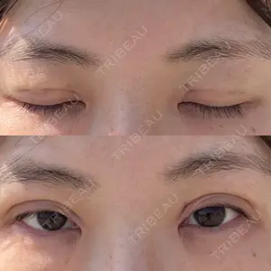 湘南美容クリニック 湘南美容クリニック 千葉センシティ院口コミ