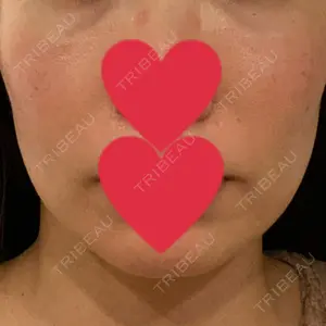 ルラ美容クリニック ルラ美容クリニック 渋谷本院口コミ