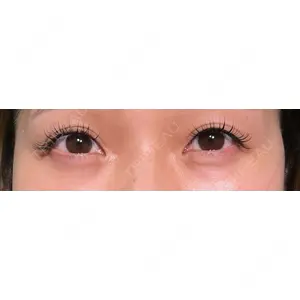 HAAB×DREAM BEAUTY CLINIC HAAB×DREAM BEAUTY CLINIC 大阪梅田院口コミ