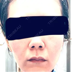湘南美容クリニック 秋葉原院口コミ
