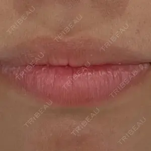 HAAB×DREAM BEAUTY CLINIC 大阪梅田院の