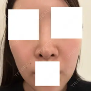 口コミ
