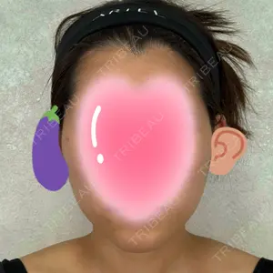 アリエル美容クリニック アリエル美容クリニック 横浜院口コミ