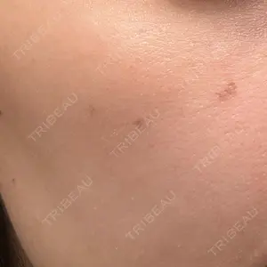 L‘amour clinic Tokyo【ラムールクリニック東京】口コミ