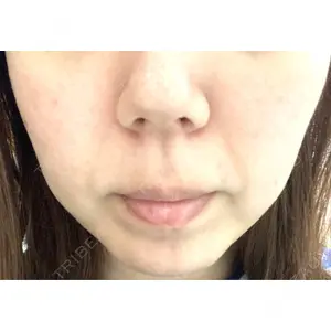 アネシス美容クリニック口コミ