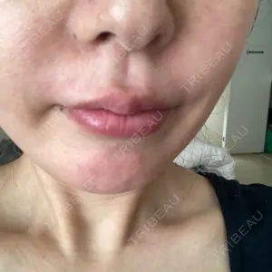 ルラ美容クリニック ルラ美容クリニック 福岡院口コミ
