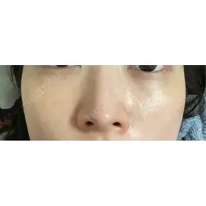 PureMe Skin Clinic（ピュアミースキンクリニック麻布）口コミ