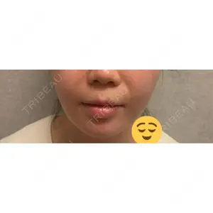 BiBiクリニック口コミ