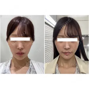 EMMO FACE CLINIC 東京三田院口コミ