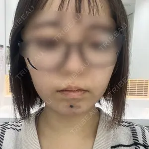 口コミ