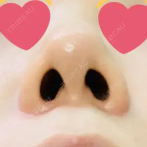 HANABI整形外科口コミ