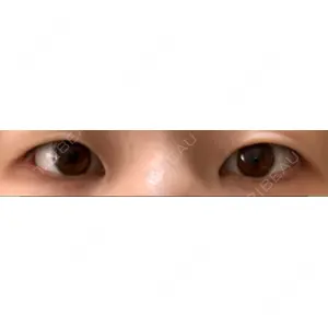 湘南美容クリニック 湘南美容クリニック 京都院口コミ