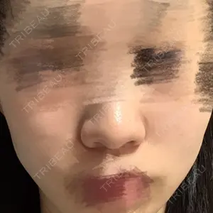 リッツ美容外科 大阪院口コミ