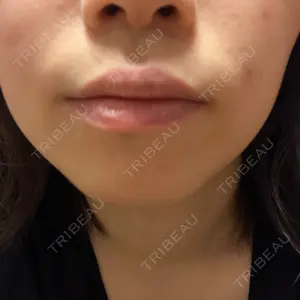 ルラ美容クリニック ルラ美容クリニック 新宿院口コミ