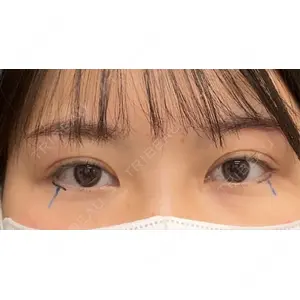 口コミ