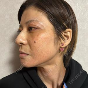 メディアージュクリニック メディアージュクリニック 名古屋院口コミ
