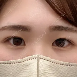 TCB東京中央美容外科 前橋院口コミ