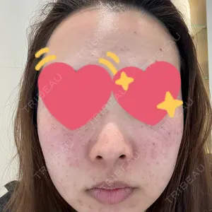 MIO CLINIC 梅田院口コミ
