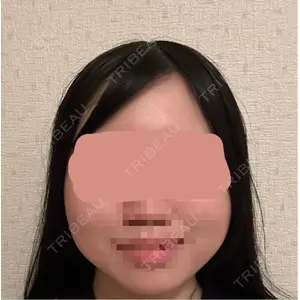 東京ココセランクリニック口コミ