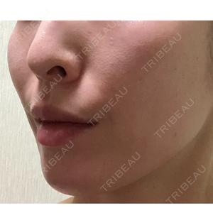 ルラ美容クリニック ルラ美容クリニック 名古屋本院口コミ