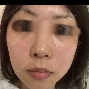 ルラ美容クリニック ルラ美容クリニック 新宿院口コミ