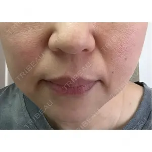 RAISE CLINIC 【レイズクリニック】口コミ
