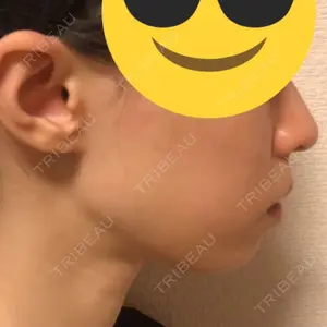 リッツ美容外科の口コミ